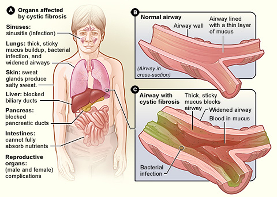 Organs Affected